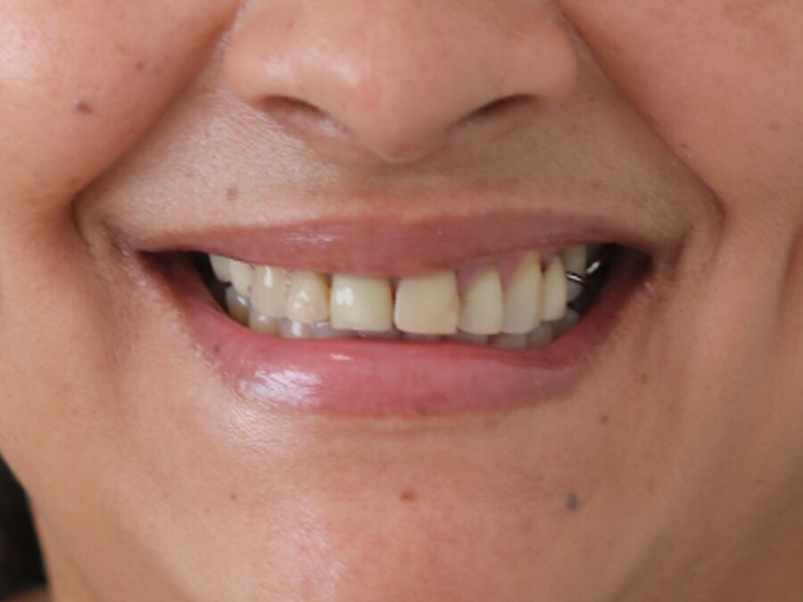 Imagem inicial, caso de reabilitação estética