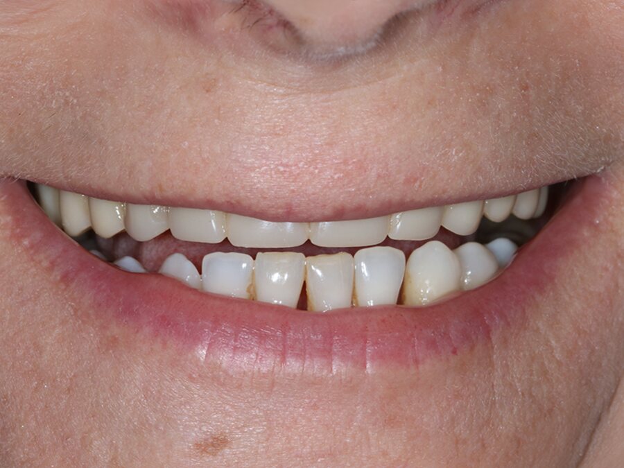 Imagem inicial, caso de harmonização do sorriso